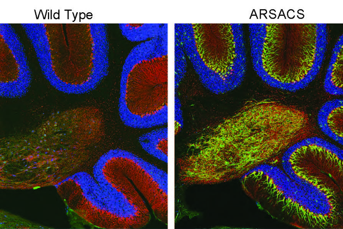 ARSACS cells