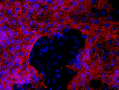 Stem Cell Differentiation