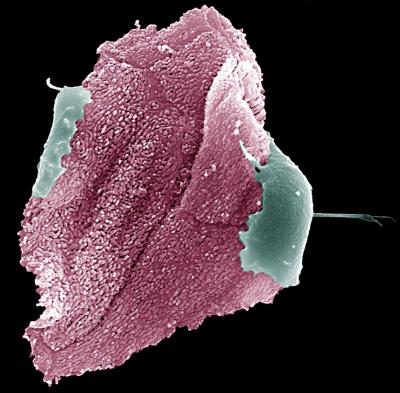 Genome Sequence of Common STD Bug 2 (of 2)