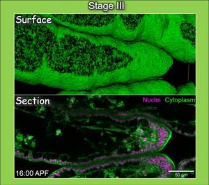 Live Imaging from Stage III to Stage V