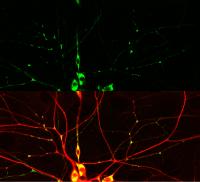 Key Protein Discovered That Allows Nerve Cells to Repair Themselves (2 of 2)