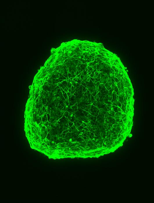 A ball of neuroblastoma cells forming mature nerves after drug treatment