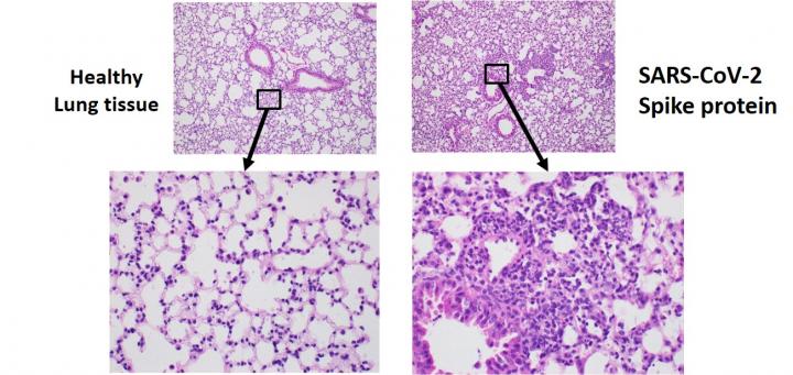 Lung tissue and SARS-CoV-2 spike protein