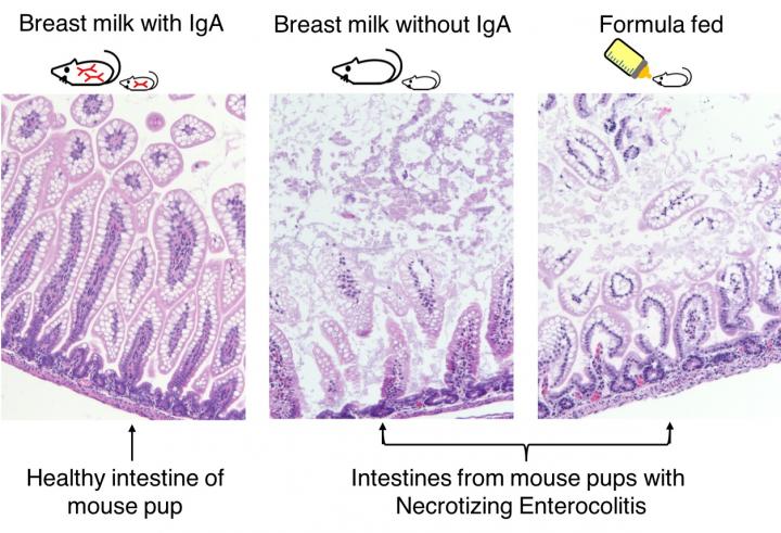 Breastfeeding Itself is Not Enough