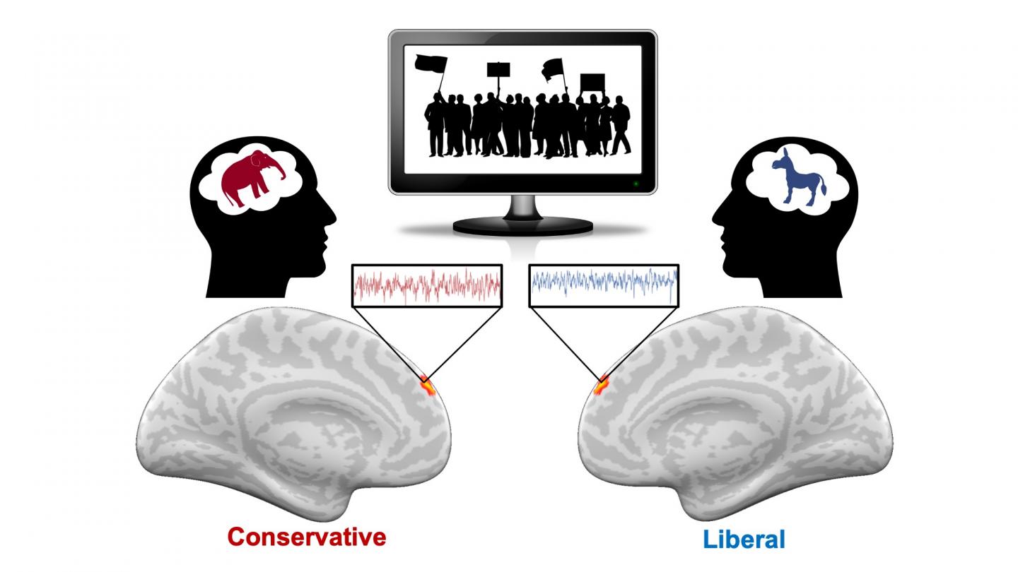 Partisan brain differences