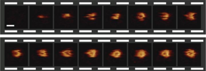 Video Sequence of the Formation of a Hole in a Bacterial Surface