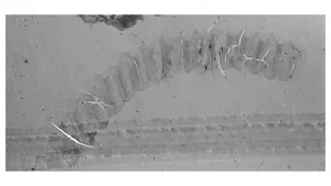 TEM image of the wall structure of a Holocene euglenoid cyst