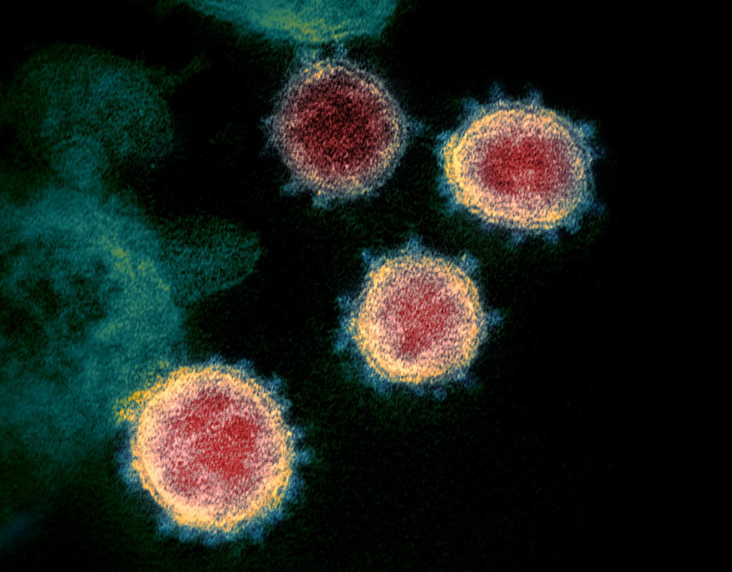 SARS-CoV-2 virus particles emerging from the surface of cells