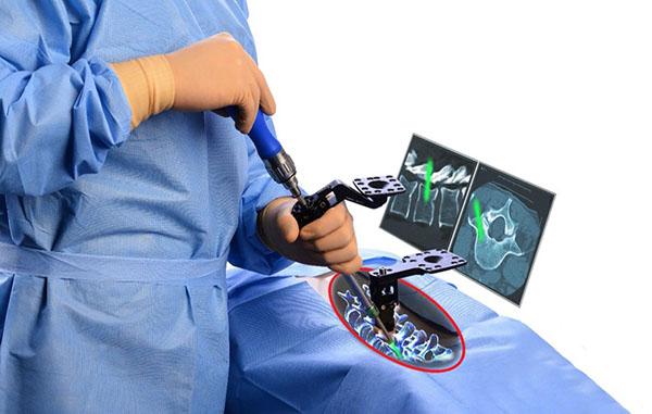 Artist rendering of augmented surgery