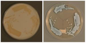 The novel type of Candida auris grown on different types of culture media