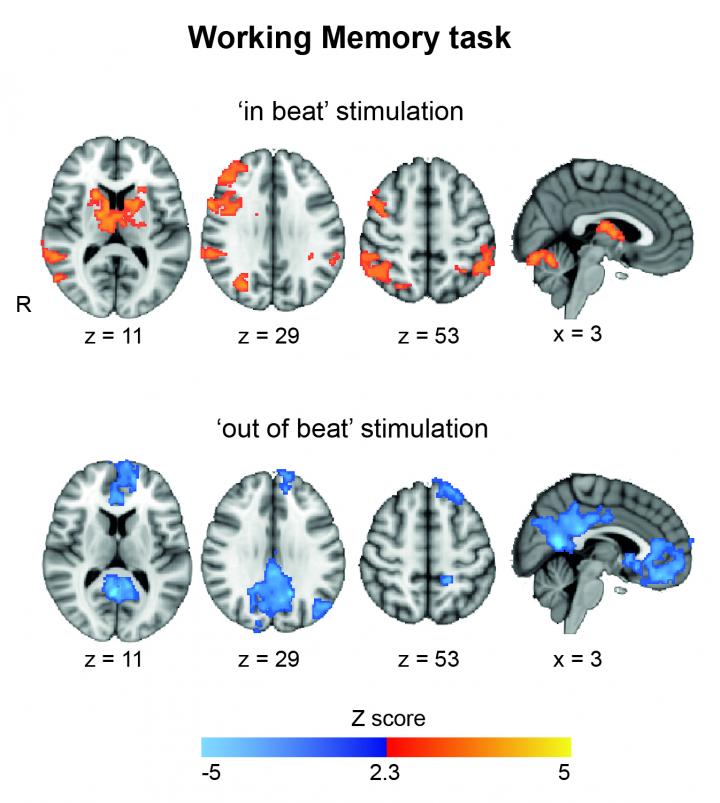 Brain Activation Patterns During Stimulation