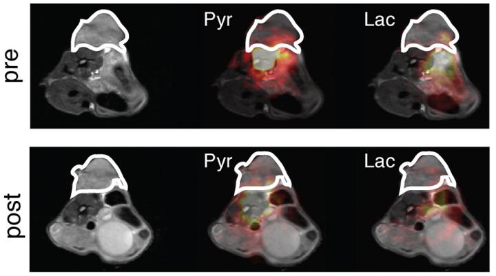 False Color Image of a Breast Tumor Pre- and Post-Treatment