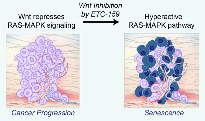 Blocking Wnt signalling leads cancer cells to undergo senescence