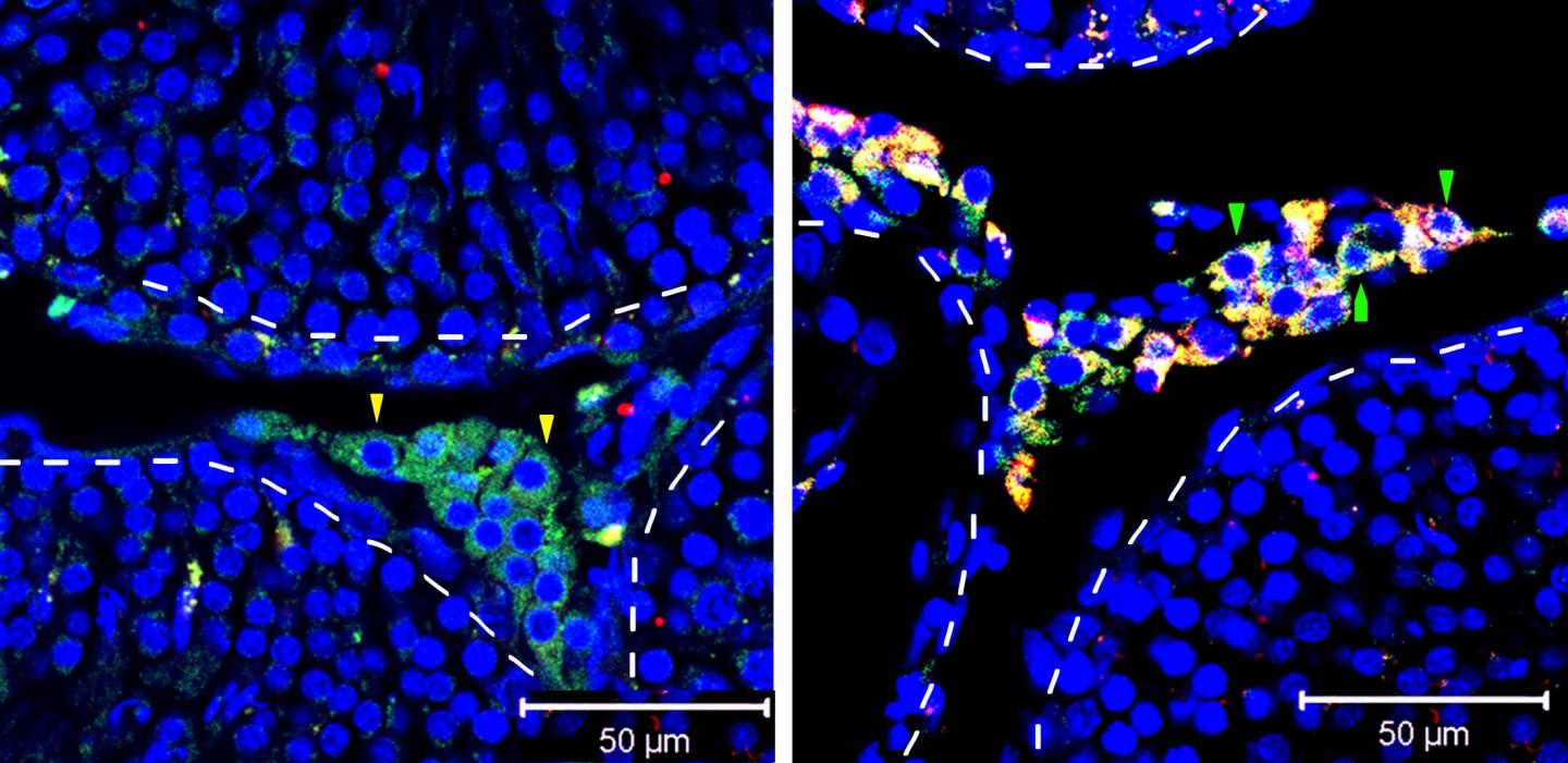 Leydig-Like Cells Made From Stem Cells