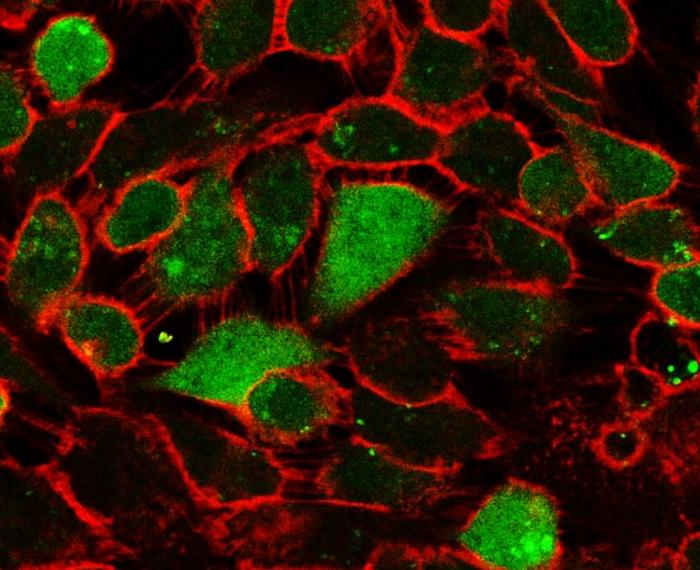 A population of breast cancer cells