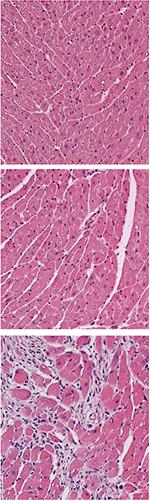 Heart's Own Immune Cells Can Help It Heal