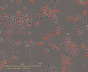 Breast cancer cell line MDAMB468