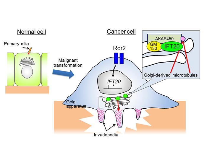 がん細胞での細胞内タンパク質「IFT20」の働きを解明