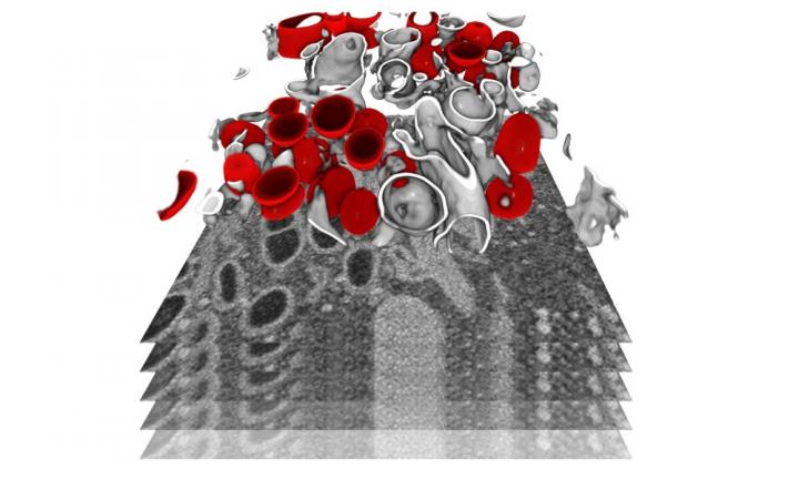 SARS-CoV-2 replication organelles in 3D