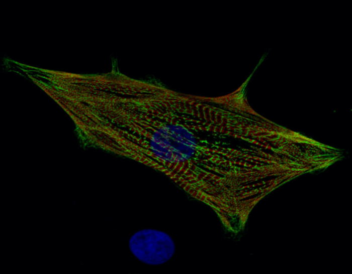 Heart muscle cells