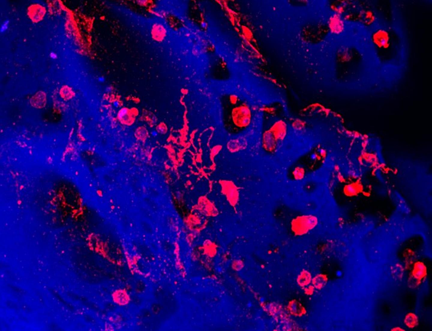 Megakaryocytes Forming Platelets