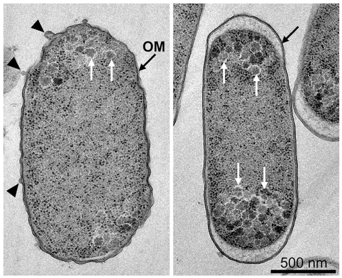 microscopic bacteria