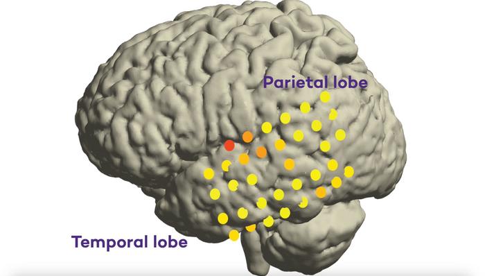 Brain regions involved in speech intent