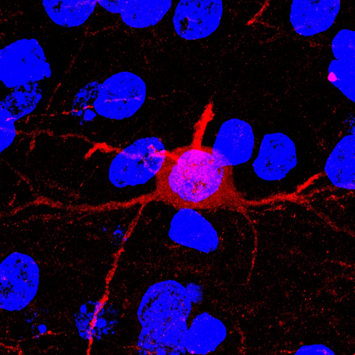 Wild-type HDAC5.