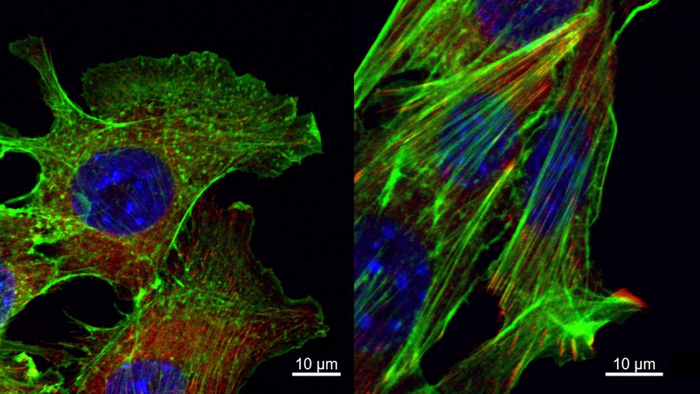 Cancer Cell Movement