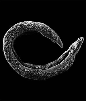 Study Sheds Light On Why Parasite Makes TB Infections Worse