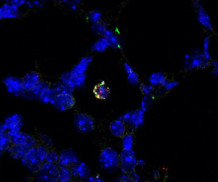 Macrophage in the Mouse Lung