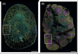 Immunofluorescence images showing a chronically helminth infected lymph node (A) or resistant lymph node (B)