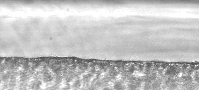 Pancreatic Cancer Cell Invasion