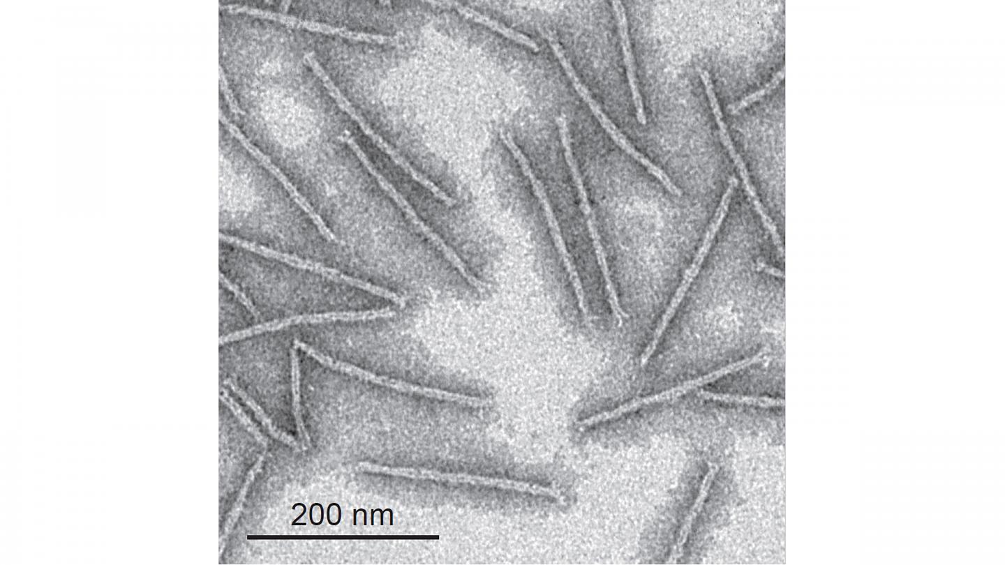 electron microscope dna