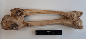 Right tibia and fibula