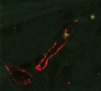 Monocyte in Brain Tissue