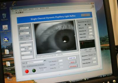 A Computer's Take on Autism