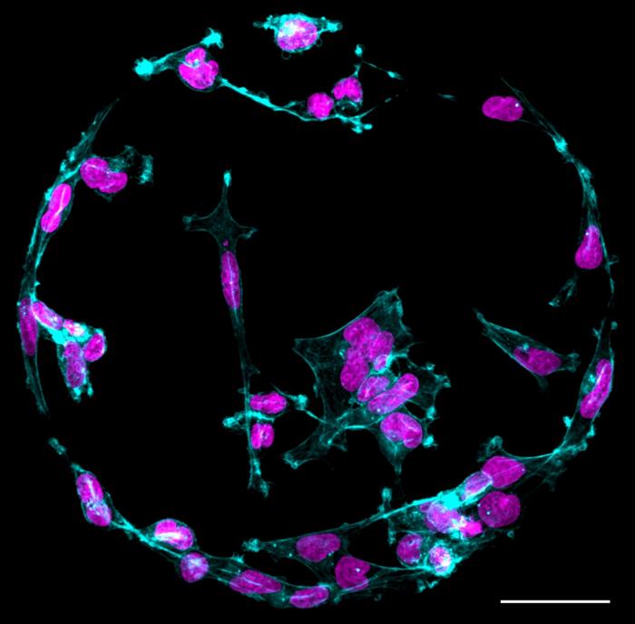 Figure showing cancer cells on a printed protein spot.