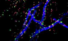 Axon Initial Segments Their Synapses