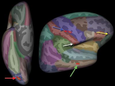 Atlas Brain Image 