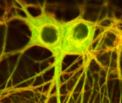 Light-activated Compound Silences Nerves, May One Day Help Epileptics