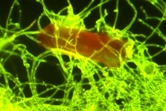 A plastic particle (red) is colonized by the marine fungus Parengyodontium album (green)