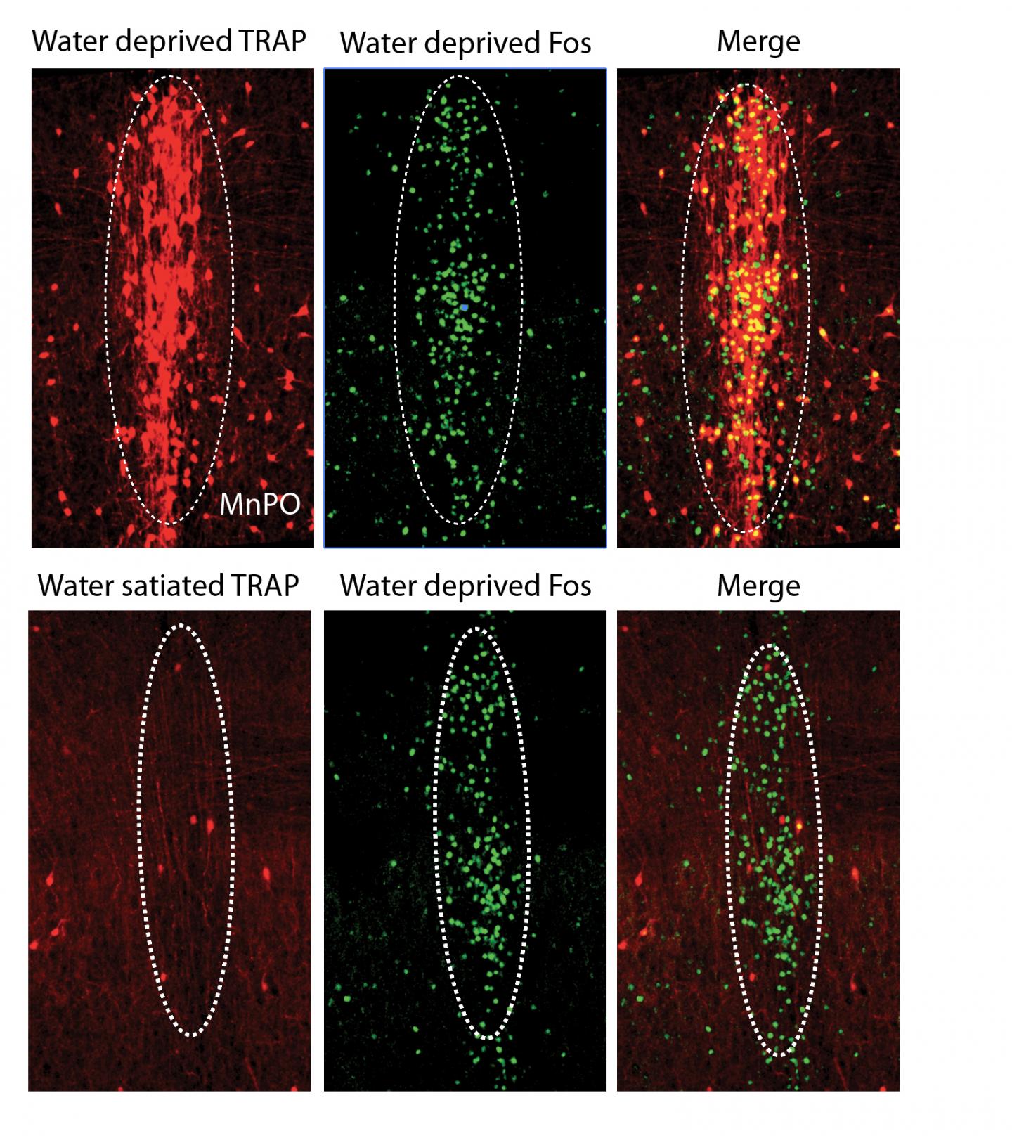 The Neurons that Will Quench Your Thirst (2 of 3)