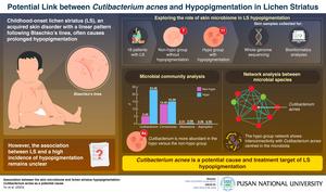 Hypopigmentation in lichen striatus may be caused by Cutibacterium acnes.