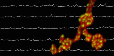 Brain Noise Found to Nurture Synapses