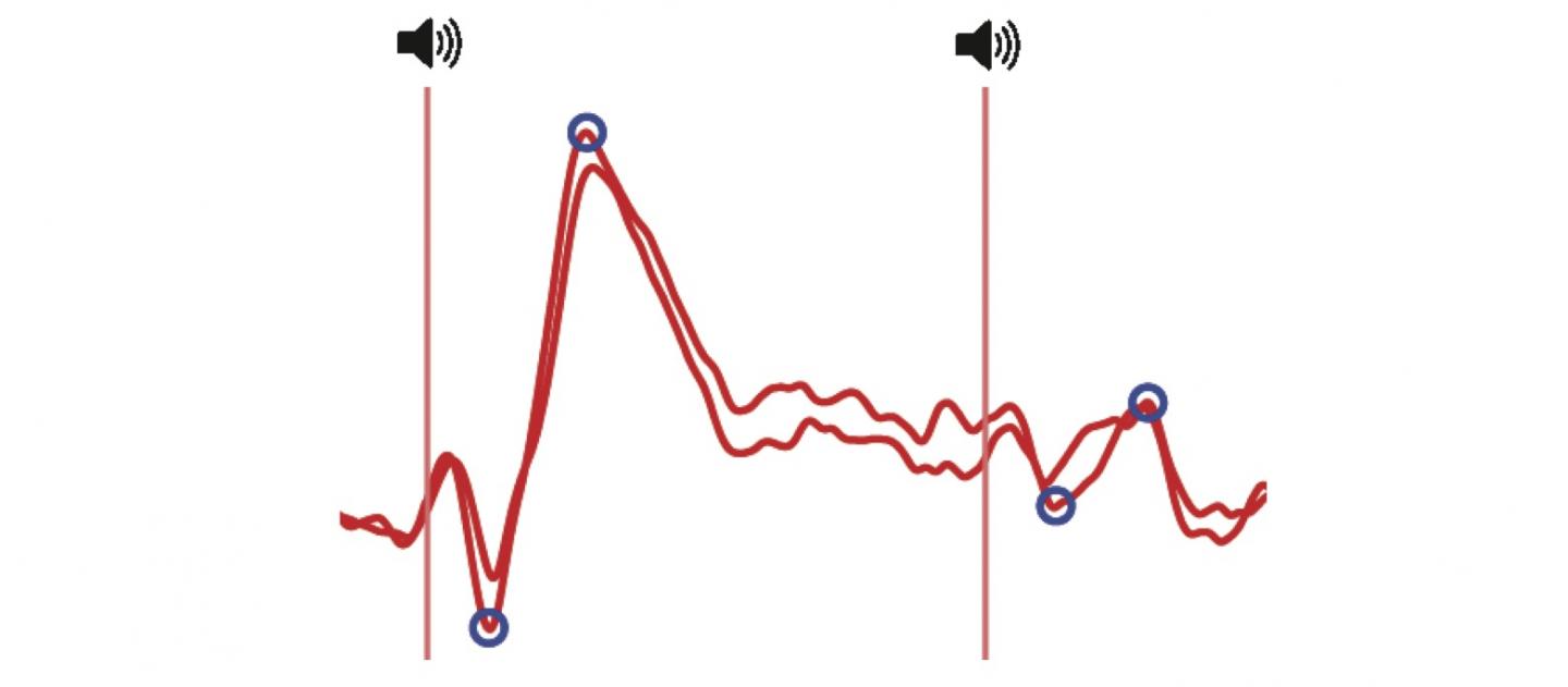 Decreased Brain Response to the Same Repeated Sound