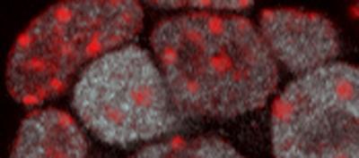 Heterochromatin Domains Visualized in Embryonic Stem Cells