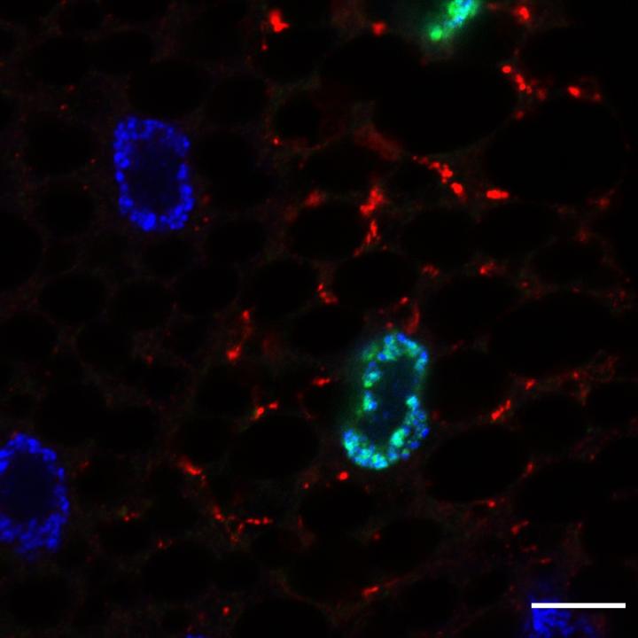 GFP-Sequoia-LIR Mutant