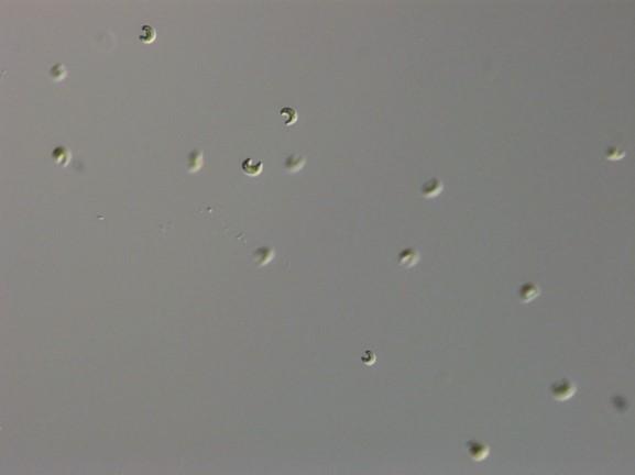 Several Cells of the Prey Species, the Green Alga Monoraphidium minutum
