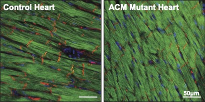 Figure 3: Plakophilin-2 levels (red) are reduced in the hearts of ACM mice compared to healthy control mice. Heart muscle cells are shown in green, cell nuclei are shown in blue.